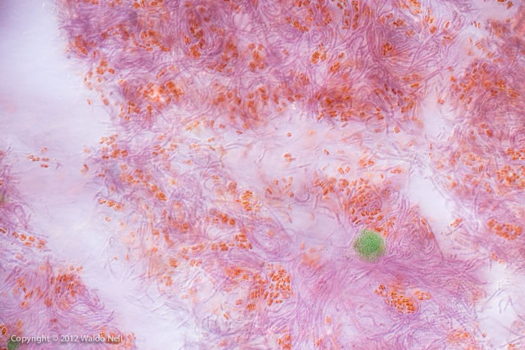 Cyanobacteria?