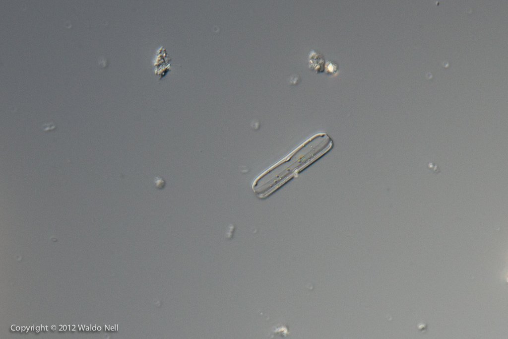 Diatom 40x DIC