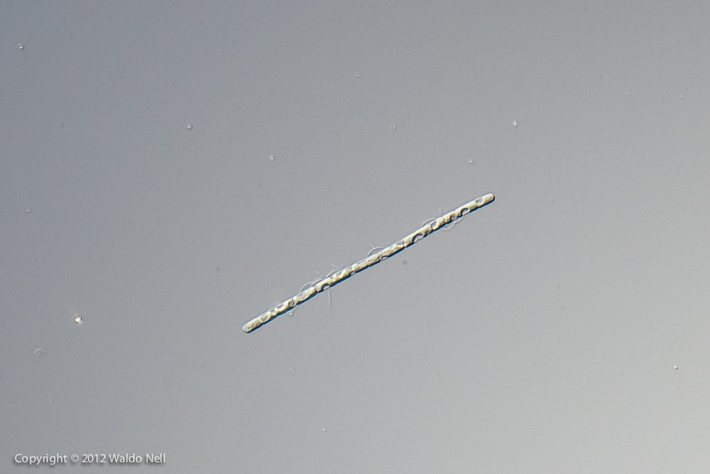 Diatom (?) 40x, DIC