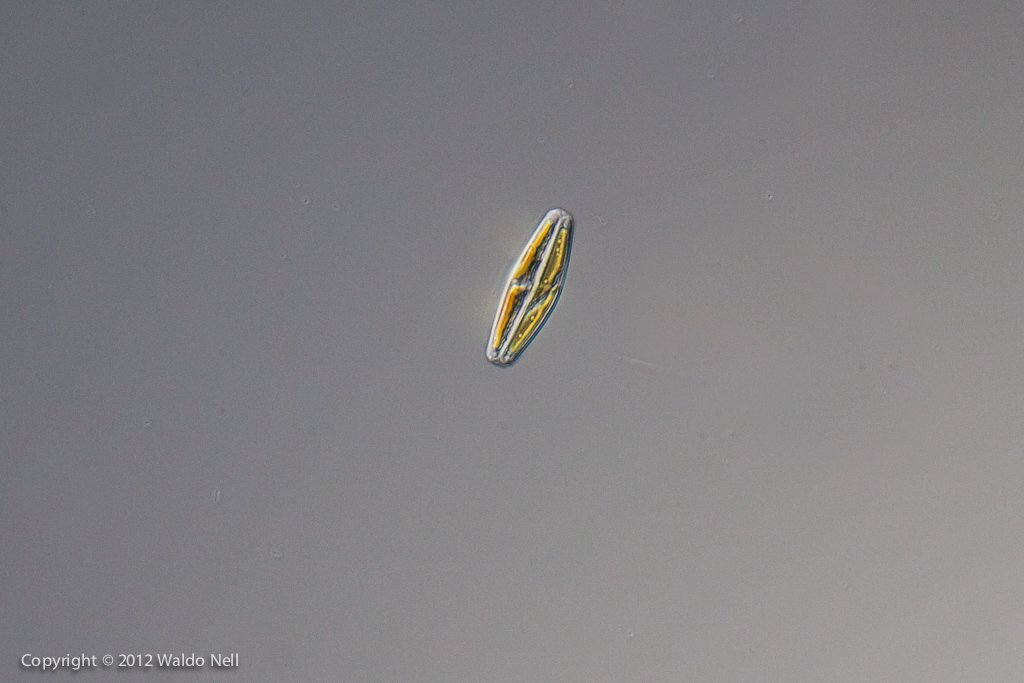 Diatom 40x, DIC