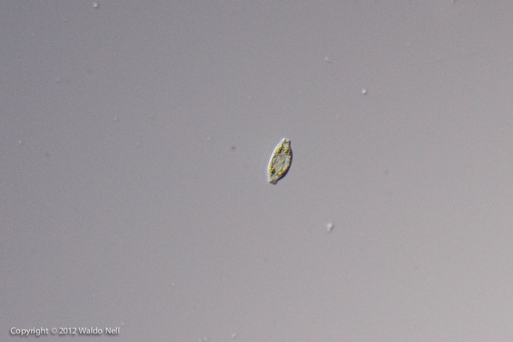 Diatom 40x, DIC