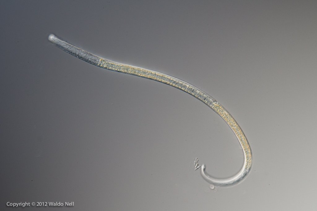 Nematode 40x, DIC