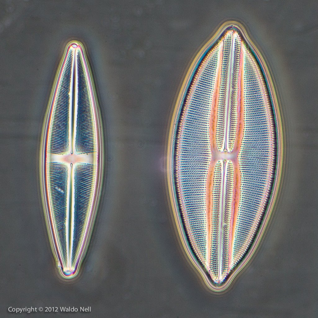 Diatoms, 40x * 2, Phase Contrast