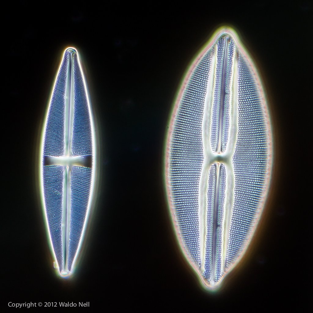 Diatoms, 40x * 2, Dark field