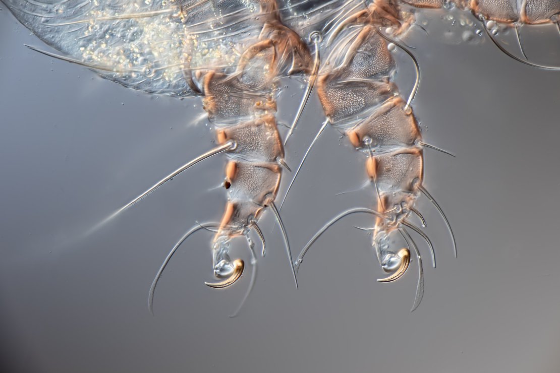 Chaetodactylidae mite claws, 60x/1.2, DIC, HF A+B+C