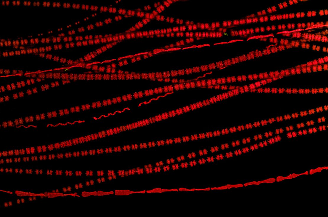 Algae chloroplasts autofluorescence under UV light